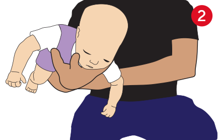 Coloque a sua mão entre as pernas do bebê e segure a cabeça na região do mento (queixo).