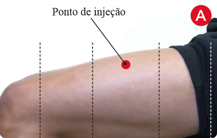 Etapa A