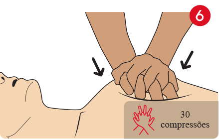 Inicie as compressões (30).